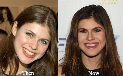 alexandra daddario boob job|10 Stars Who Have Undergone Breast Reduction Surgery